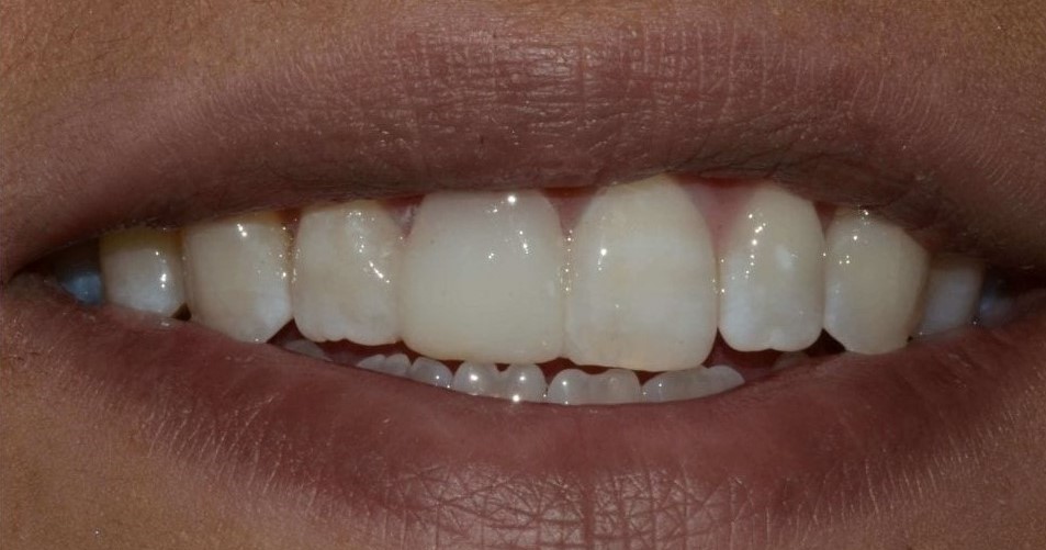 dental-after-1.jpg